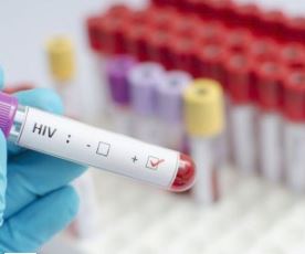 URUKINGO RUSHYA RWA VIRUSI ITERA SIDA, RURI GUTANGA ICYIZERE KO RUSHOBORA KUGIRA IMPINDUKA RUZANA