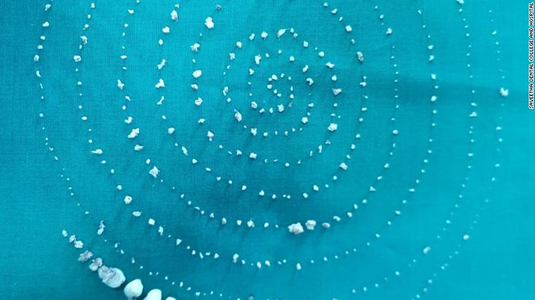 India: Umwana w'umuhungu w'imyaka 7 yasanzwemo amenyo 526