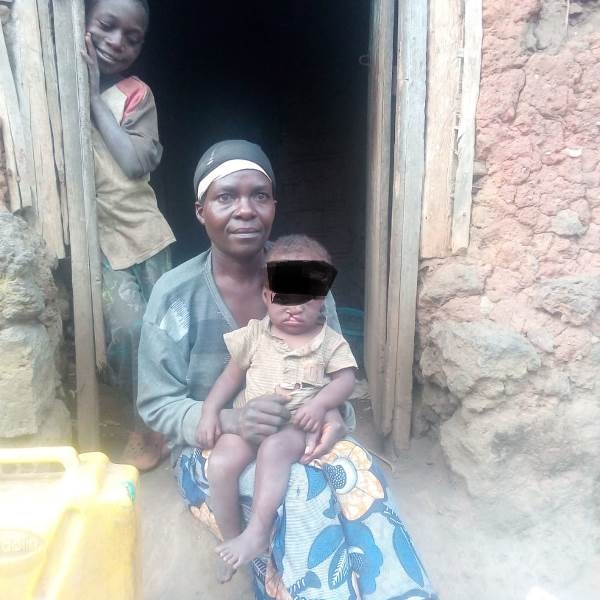 Musanze: Nyiranzabarinda aratabaza akarere kubera ubuzima abayemo n'umwana we wavukanye ibibari bakanga kumuvura kuko ari mu mirire mibi